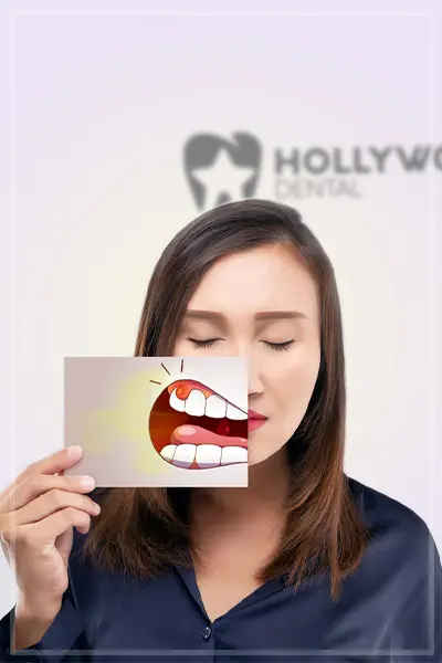 Hollywood Dental category2