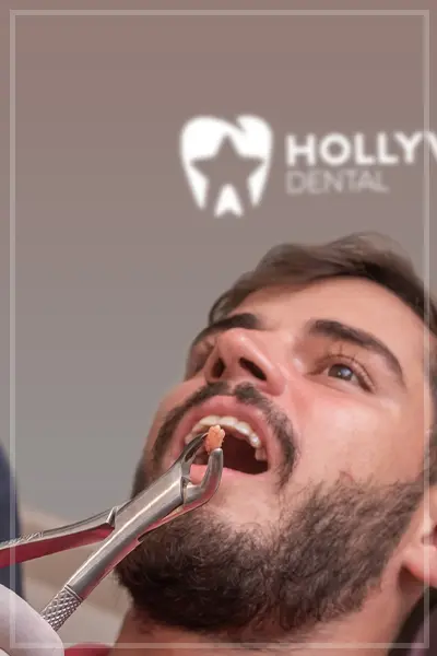 Hollywood Dental category4 1