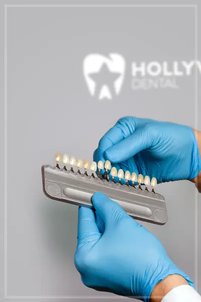 Hollywood Dental category5
