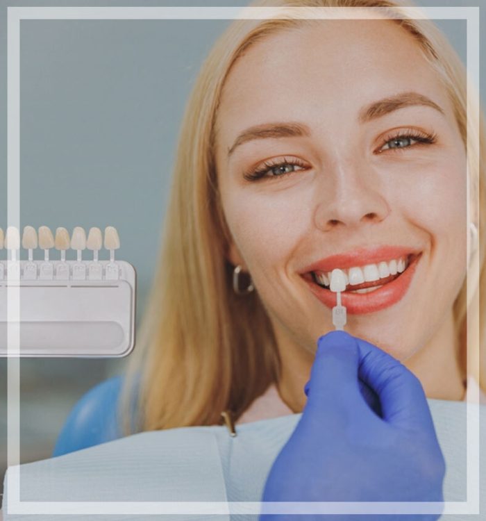 hollywood dental porzellan veneers1 Veneers Landing Page