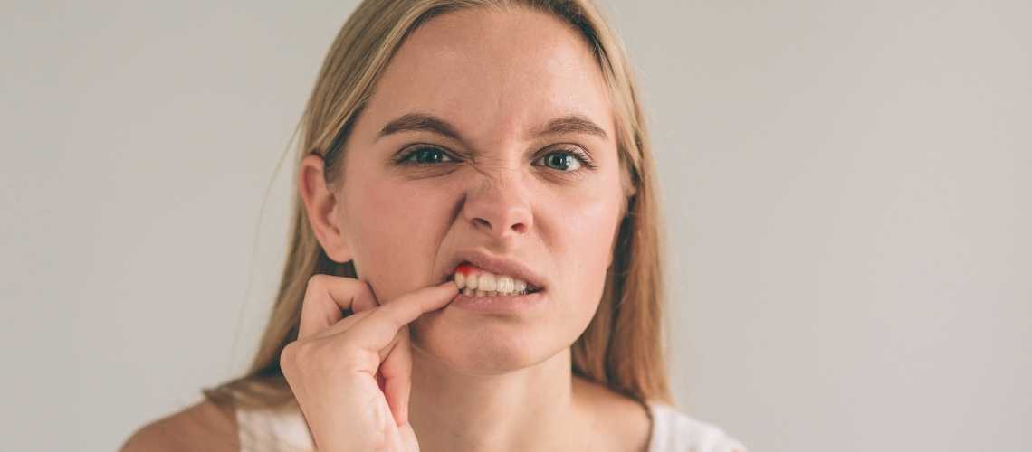 Wie entsteht eine Zahnfleischentzündung?