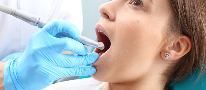 Kanal Tedavisi (Endodonti) Nedir, Nasıl Yapılır?