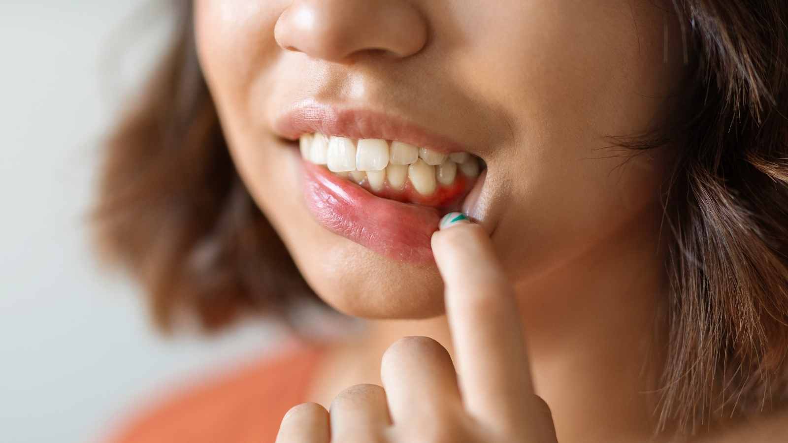 Gingivitis-Konzept. Junge Frau zieht ihre Lippe und zeigt gereiztes Zahnfleisch