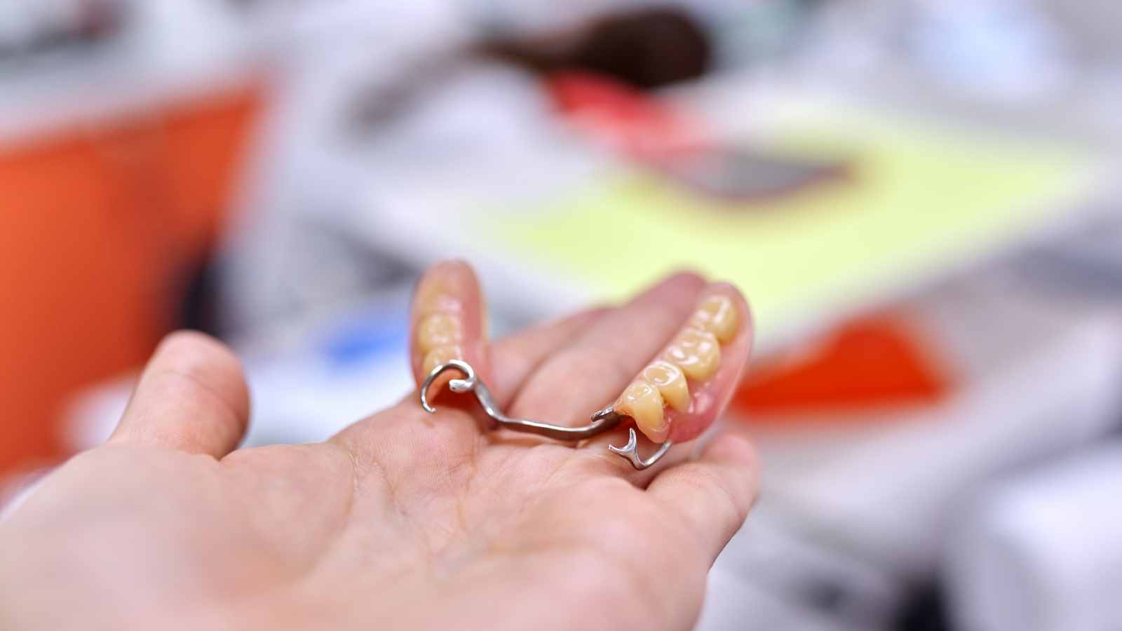Zahnimplantat-Modell, Zahnbrücke in der Hand, Hintergrund der Zahnarztpraxis⁠