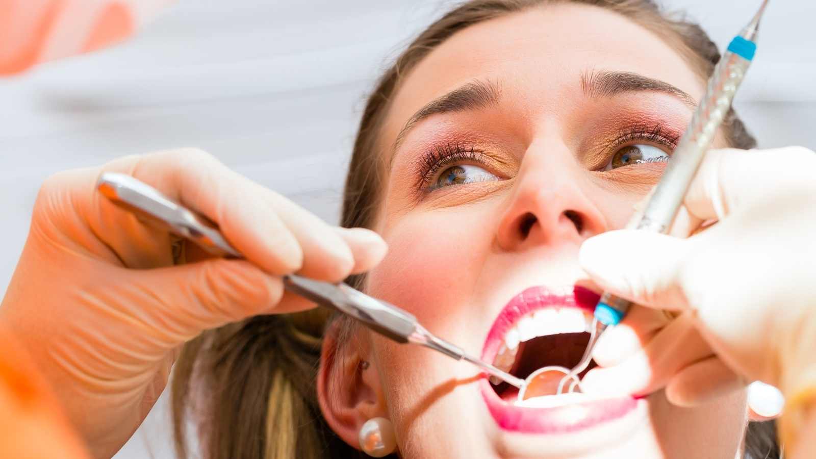 Diş Temizliği Yaptıran Hasta ⁠