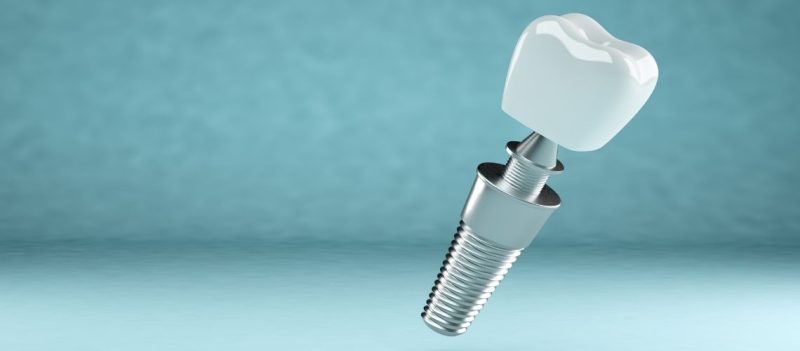 Implant Vidasi Takildiktan Sonra Dikkat Edilmesi Gerekenler