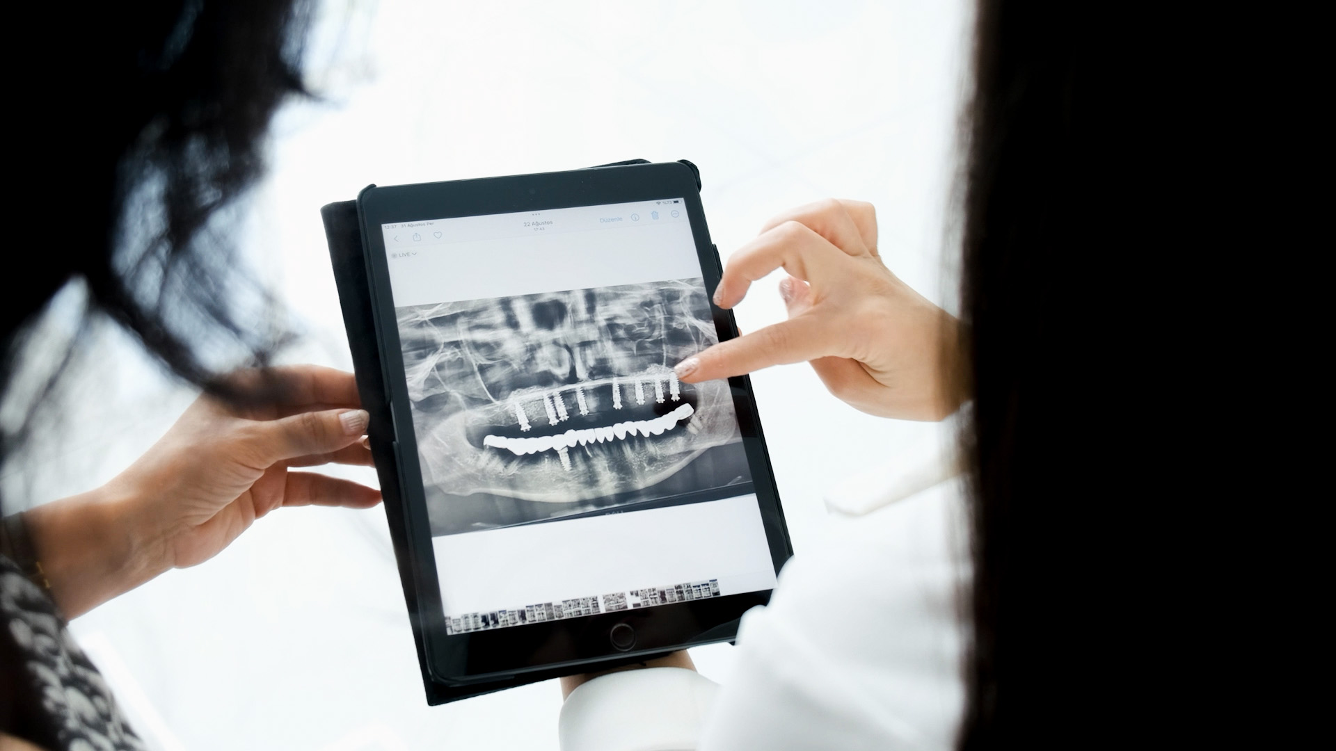 Röntgenfoto van de mond voor tandheelkundige behandelplanning